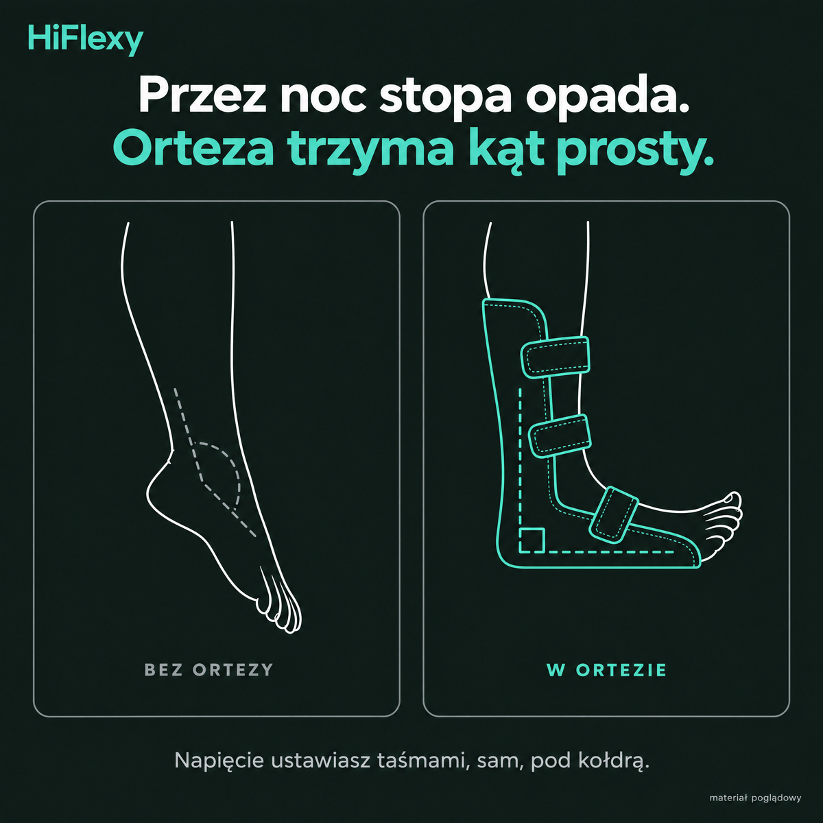 Orteza trzyma stopę pod kątem prostym